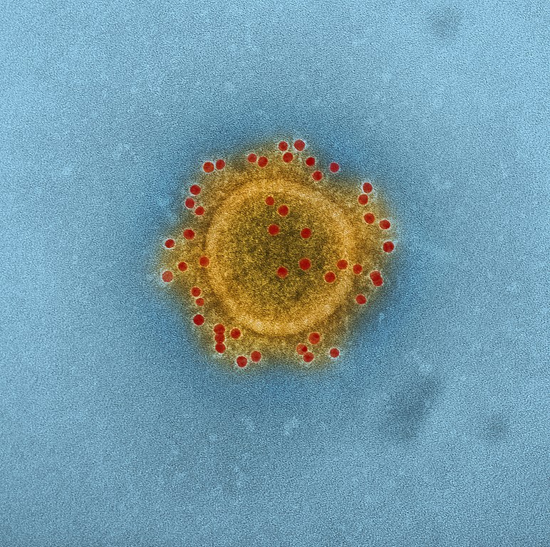 A colorized micrograph of the Middle East Respiratory Syndrome Coronavirus particle envelope proteins immunolabeled with Rabbit HCoV-EMC/2012 primary antibody and Goat anti-Rabbit 10 nm gold particles.